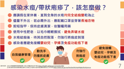 感染水痘怎麼辦